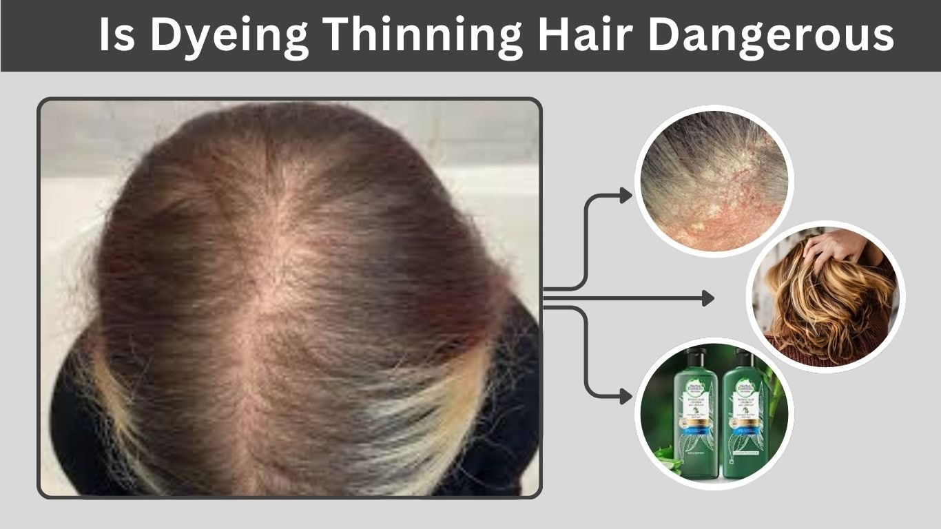 Is Dyeing Thinning Hair Dangerous? Risks, Causes & Safe Hair Coloring Tips