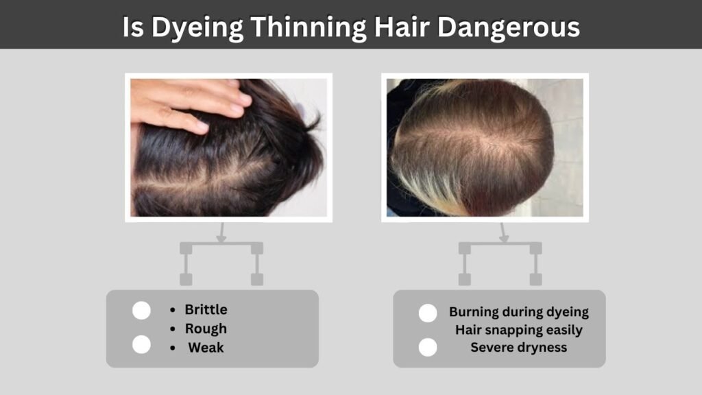Is Dyeing Thinning Hair Dangerous?