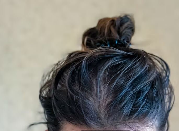 Why Do the Roots of My Hair Hurt? An In-Depth Look at Scalp Pain and Sensitivity