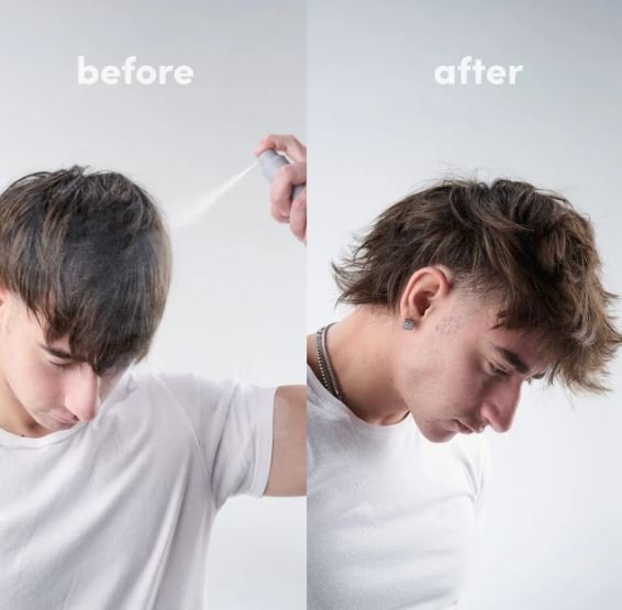 Will Using Texture Powder and Hair Clay Every Day on Your Fringe Cause Acne?